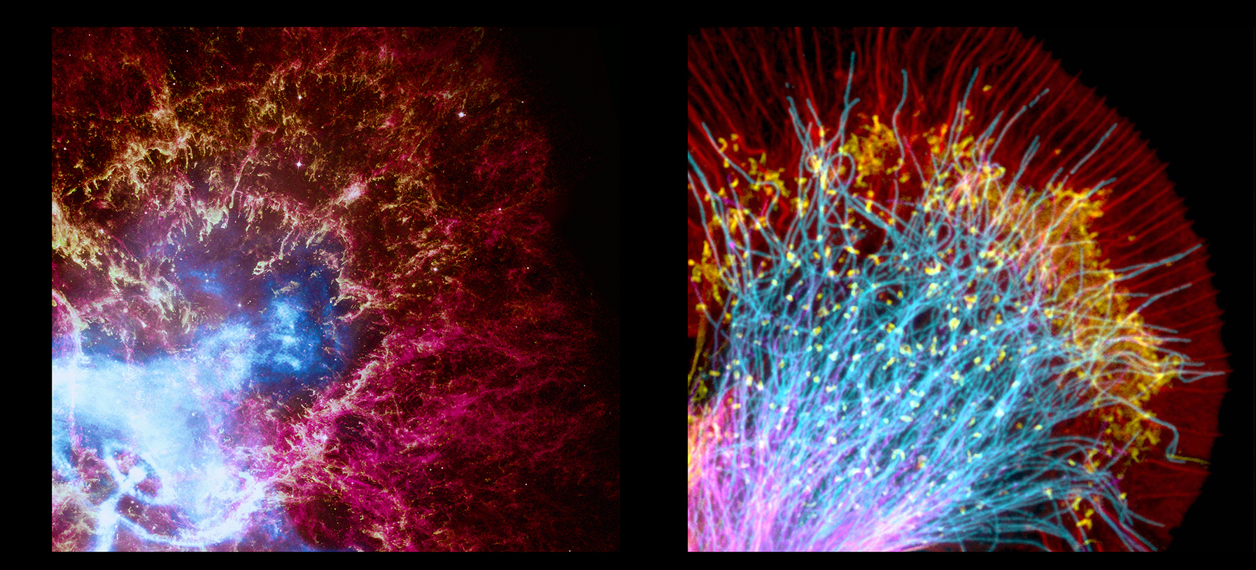 Dead Star vs.  Sea Slug Nerve Cell