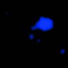 X-ray image
